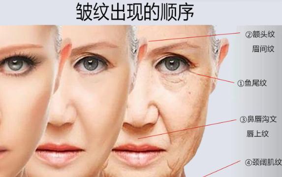 皺紋是怎么樣產(chǎn)生的呢？眼部皺紋怎樣減少?